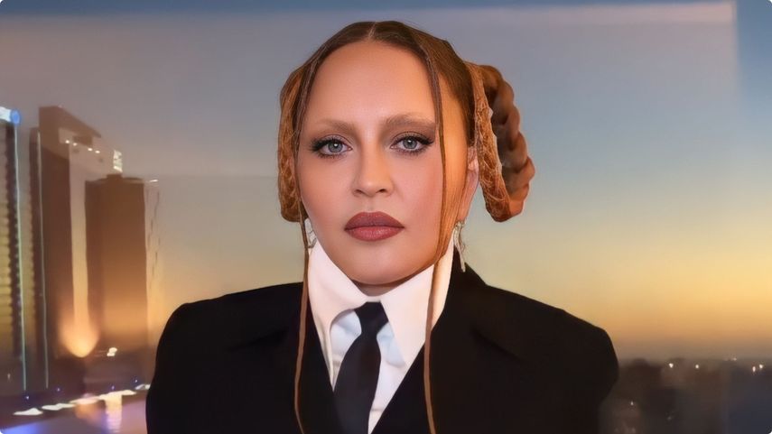 Madonna es dada de alta luego de ser hospitalizada en la UCI