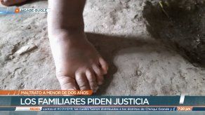 Denuncian otro caso de maltrato físico contra una menor en la Comarca Ngäbe Buglé