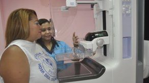 Hospital Susana Jones ofrecerá servicio de mamografía digital desde abril