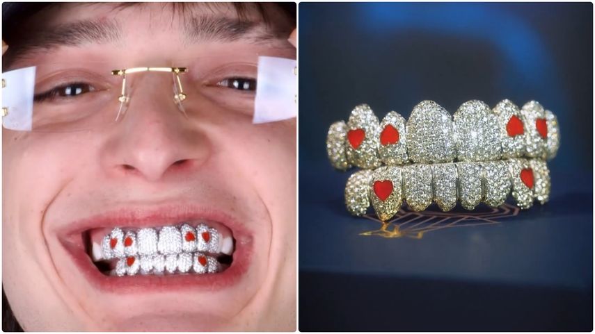 Grillz, la sonrisa del millón de dólares