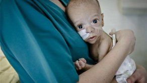 Nueva esperanza para bebé rumano con intestinos atrofiados