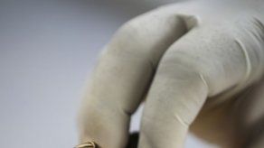El veneno de una tarántula permite arrojar luz sobre la activación del dolor