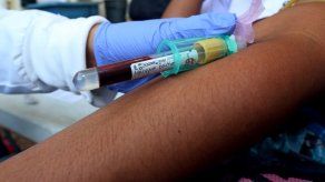 Censo preventivo revela un 33% de mayores de 40 años con problemas de colesterol