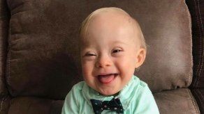 La nueva imagen de Gerber es un bebé con síndrome de Down