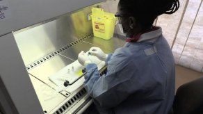 Paciente de VIH en remisión sin medicamento no es la cura pero da esperanza