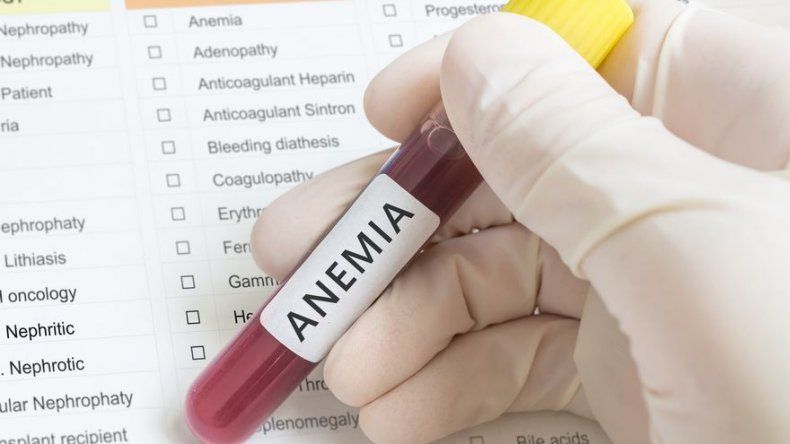 Más del 50 % de los menores de dos años tienen anemia en Panamá, según la FAO