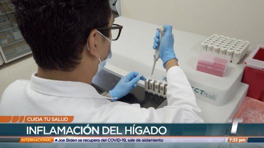 Cuida tu salud: Inflamación del hígado