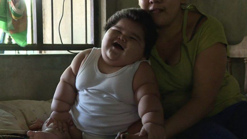 Bebé mexicano de diez meses pesa 28 kilos por deficiencia de grasas en madre