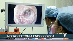 Cuida tu Salud: Necrosectomía endoscópica