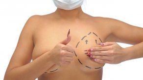 Iniciativa para crear el Fondo de Reconstrucción Mamaria fue prohijado por la Comisión de Salud