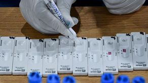 El director del Instituto Gorgas indicó que hay empresas que pueden estar introduciendo pruebas de manera ilegal.