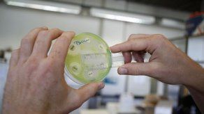 ¡Cuidado con tu cepillo de dientes!&nbsp;