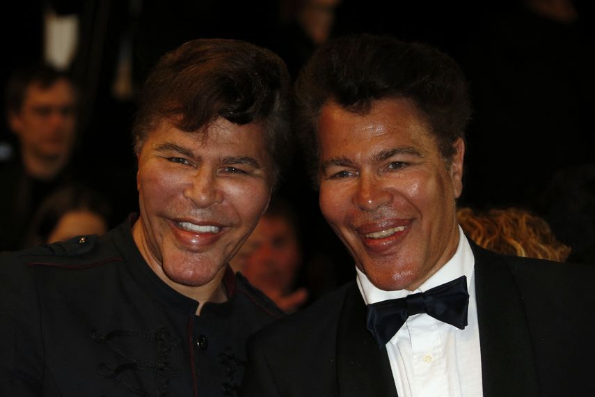 Los hermanos gemelos