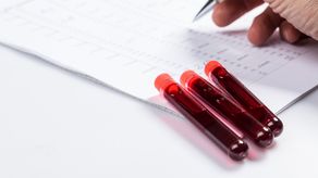 De acuerdo con las guías internacionales americanas,&nbsp;el síndrome mielodisplásico&nbsp;se trata de un tipo de cáncer en la sangre; sin embargo, las guías europeas, lo catalogan como un trastorno clonal.