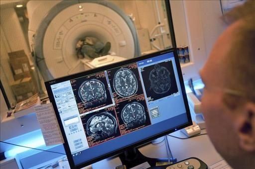 Los padres del mapa del cerebro humano temen que el programa se desenfoque