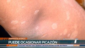 Buscan generar conciencia sobre la dermatitis atópica y otras enfermedades de la piel