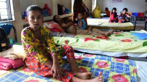 Operan con éxito a la niña árbol bangladesí