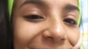 Ya siento una parte del labio superior: Ana Camila tras parálisis por intervención