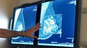 Etapa temprana de cáncer es riesgosa para algunas mujeres