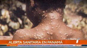 Refuerzan planes y protocolos sanitarios por la viruela del mono