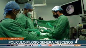 Cuida tu Salud: Quiste pilonidal