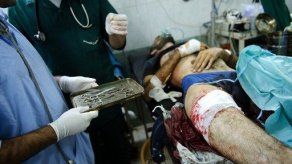 Un hospital de Alepo desafía a las bombas para curar a heridos