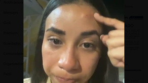 Policía responde tras denuncia de agresión