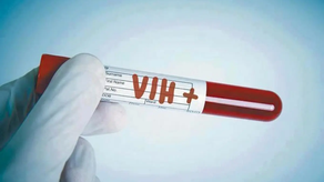 Tercer enfermo de VIH logra curarse gracias a las células madre