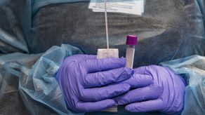 Cuba no integra el mecanismo Covax creado por la Organización Mundial de la Salud (OMS) para que los países de bajos y medios ingresos accedan a las vacunas, ni tampoco las compró en el mercado internacional.&nbsp;