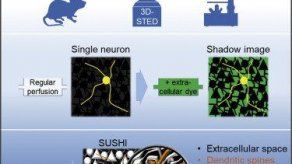 Científicos ven por primera vez todas las células de una región cerebral