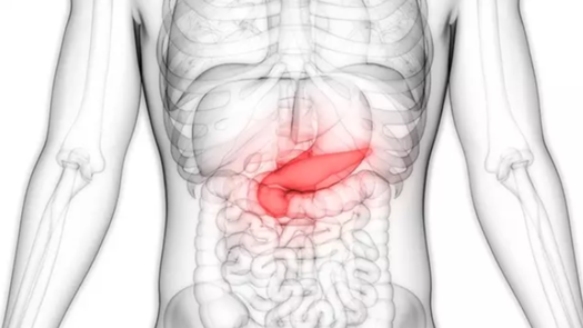 Cáncer de páncreas: ¿Qué síntomas produce y cómo detectarlo?
