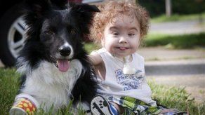 Médicos imprimen tráquea y salvan a un bebé