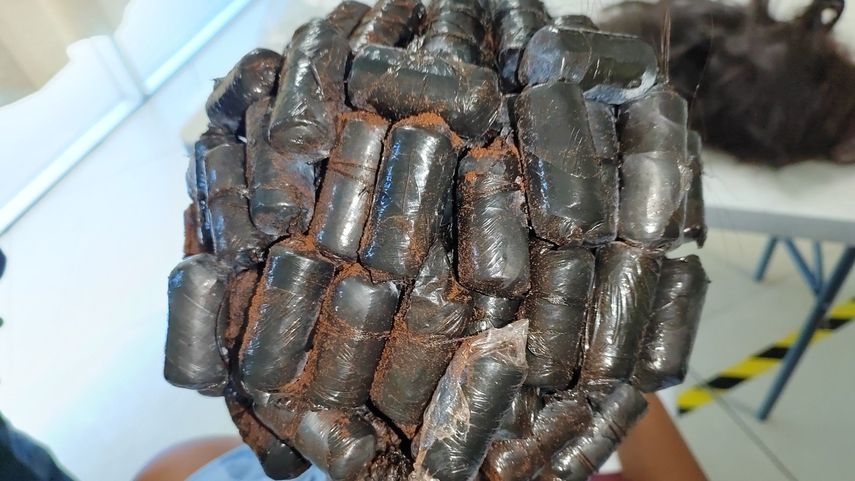 La mujer tenía 67 envoltorios de droga en la cabeza.