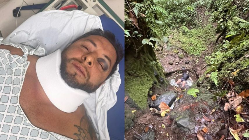 Oli Meza sobrevive de caer 20 metros de un sendero