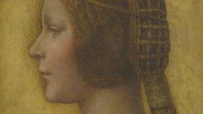 Expertos en Da Vinci