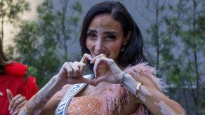 Miss Universo 2024:&nbsp; Miss Egipto rompe barreras como la primera candidata con vitíligo