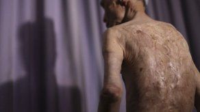 La bomba atómica de Nagasaki marcó a un hombre de por vida