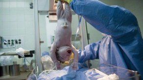 Inserción de anillo en el útero reduce 75% los partos prematuros