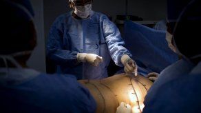 Parlatino pide a la región penalizar uso fraudulento de rellenos estéticos