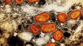 Vista microscópica del virus de la viruela del mono.