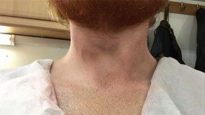 El tatuaje de un león de Ed Sheeran es falso
