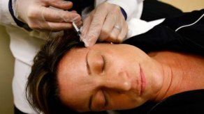 El gobierno de EE.UU. aprueba el botox para las patas de gallo