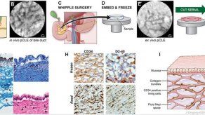 Un microscopio minúsculo desvela una parte desconocida del cuerpo humano
