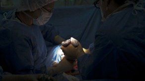 Más cesáreas en Latinoamérica por cambios en la mujer y la medicina