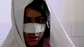 Mujer afgana agredida por su esposo pide ayuda para operarse