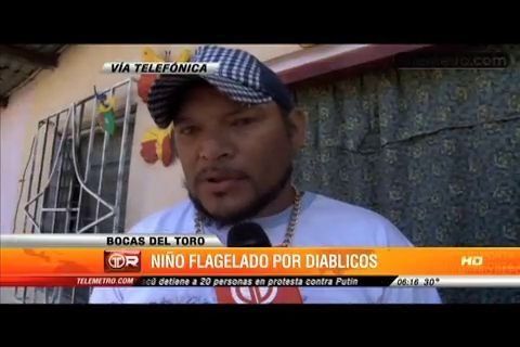 Menor de edad es maltratado por diablico sucio en Bocas del Toro