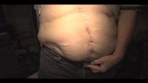 Denuncian negligencia médica en hospital privado de Chiriquí