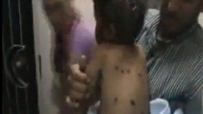 Siria rechaza estar detrás de ofensiva que dejó más de 90 muertos