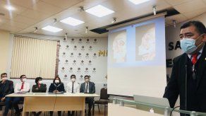 Autoridades de Salud de Bolivia informan sobre primer caso de hongo negro.&nbsp;