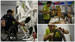 ¿Se rompió la prótesis de pierna? Vaya al hospital paralímpico